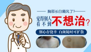 治療胸部白癜風(fēng)要避免什么?