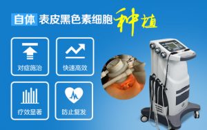出現(xiàn)白斑病情該怎么正確治療呢