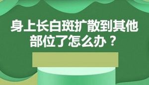 胸部白癜風會擴散到其它部位嗎