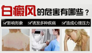 白癜風(fēng)的發(fā)生會(huì)給患者造成哪些影響