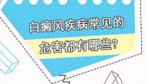 面部白斑病給患者帶來(lái)哪些傷害